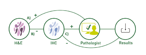 Illustration of AI process for lymph nodes